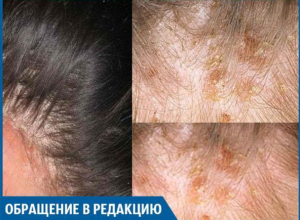 В салоне «Вероника» мне сожгли кожу головы, - волжанка В салоне «Вероника» мне сожгли кожу головы, - волжанка