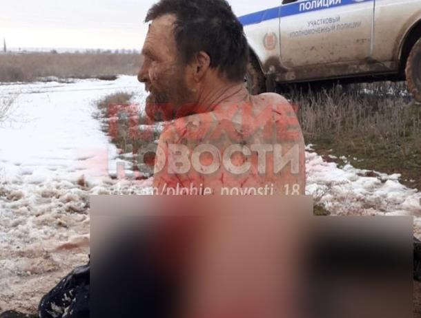 В поселке Краснооктябрьский алабаи напали на мужчину В поселке Краснооктябрьский алабаи напали на мужчину